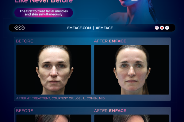 Emface_LF_Stand-insert_FAA_ENUS100_preview