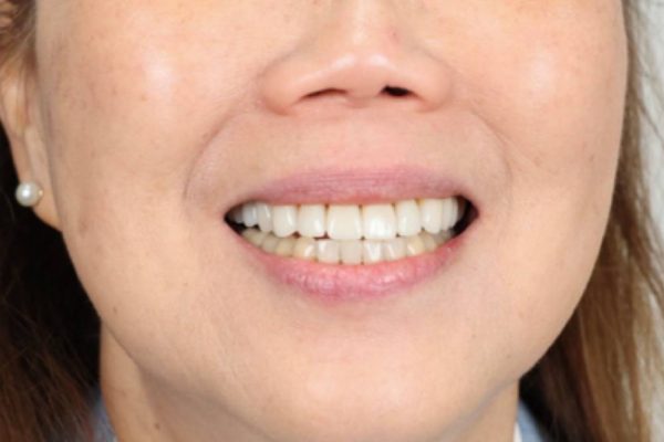 JT Full Face After cropped