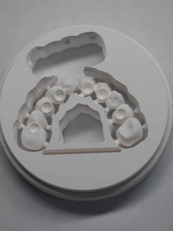 Milled-Zirconia-Bridge-for-Implants
