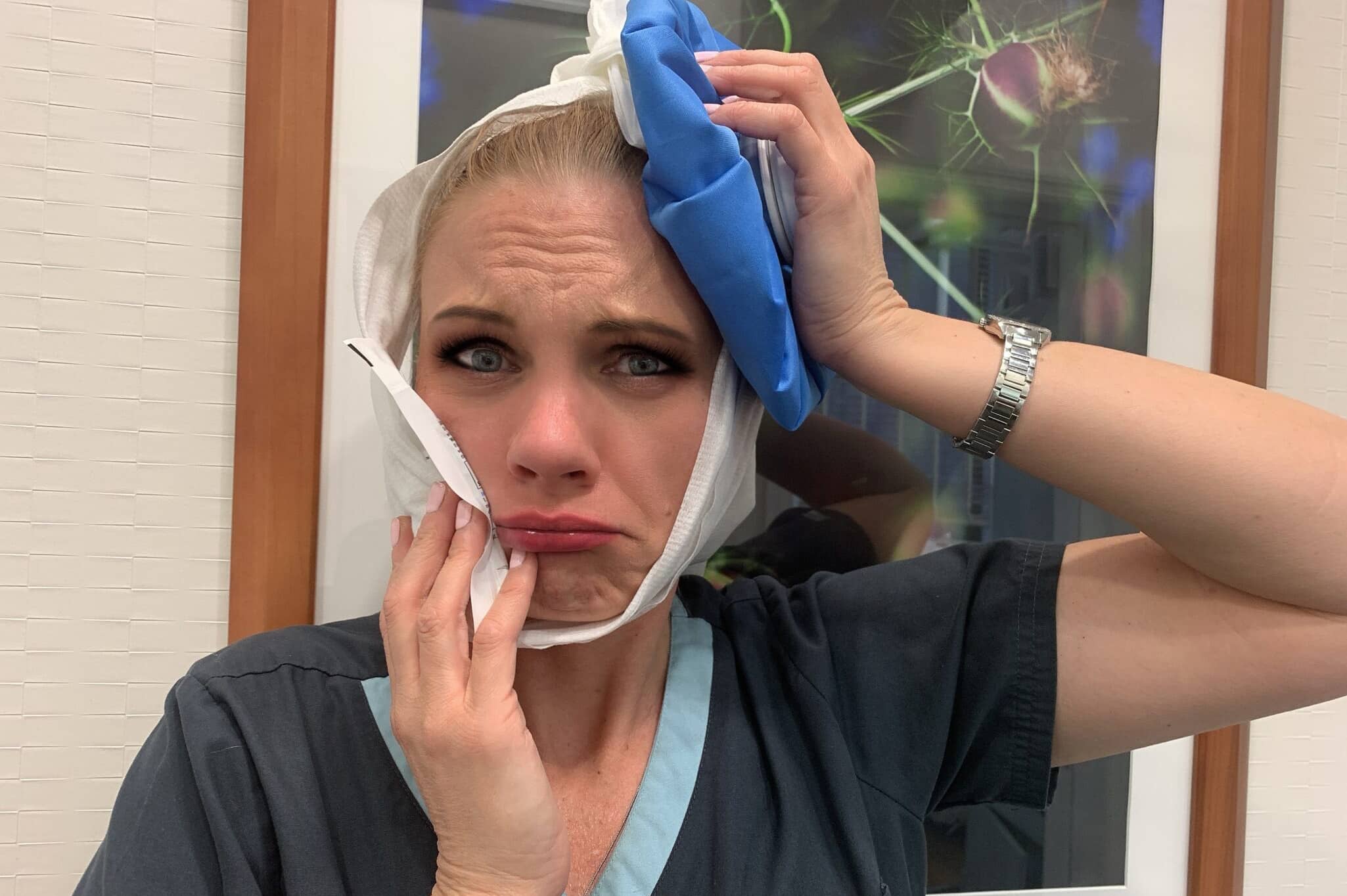 A woman holding an ice pack against her jaw with a pained expression, suggesting relief methods like Tylenol or ibuprofen for toothache – tylenol or ibuprofen for toothache