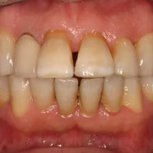 Patient #1579